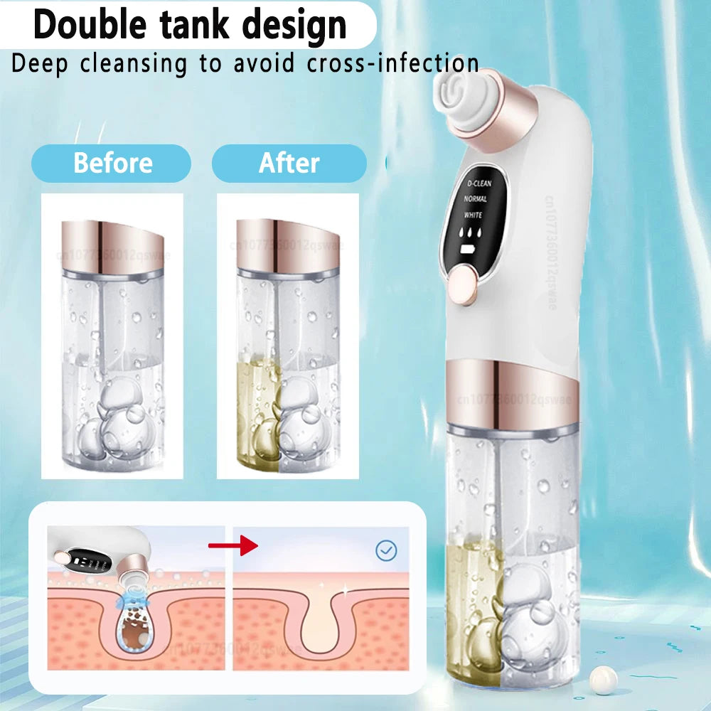 Vacuum Blackhead Remover