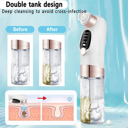 Vacuum Blackhead Remover