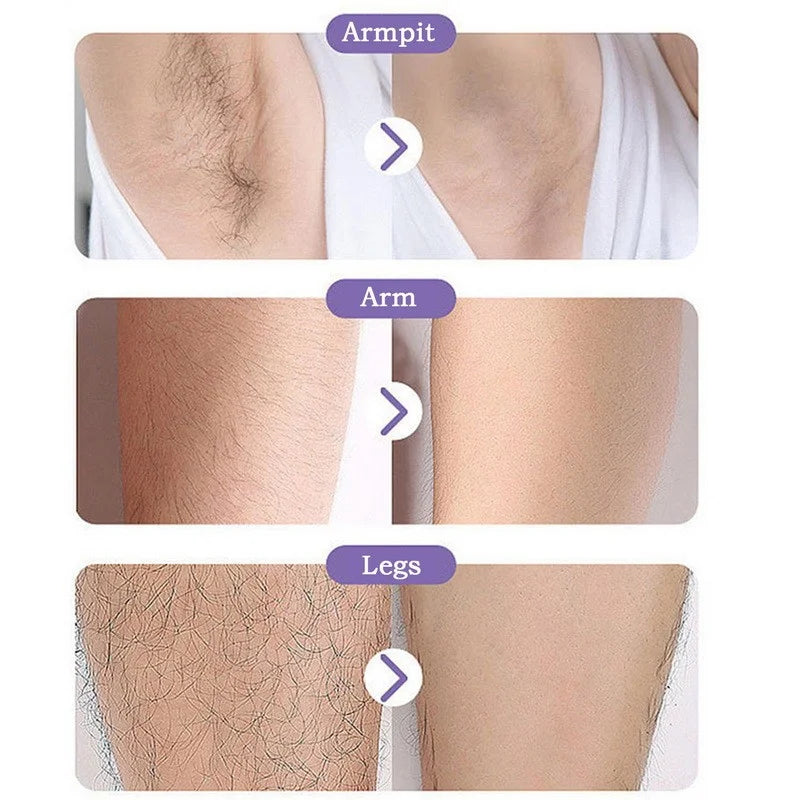 Crystal Hair Removal