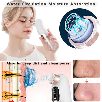 Vacuum Blackhead Remover